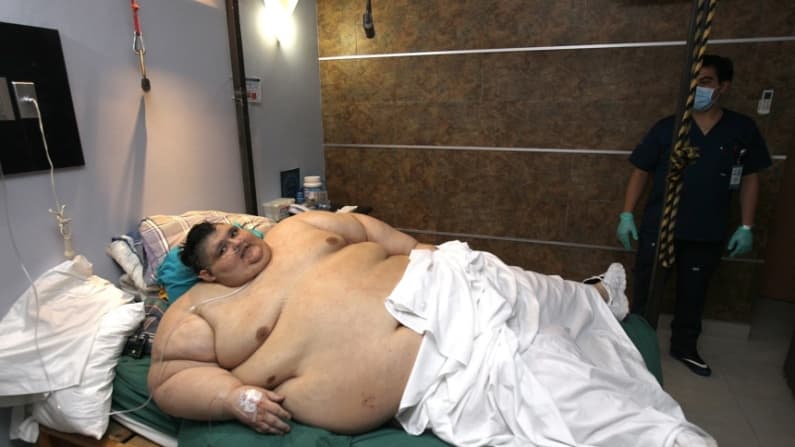 Muere Juan Pedro Franco, el mexicano que fue el hombre más obeso del mundo