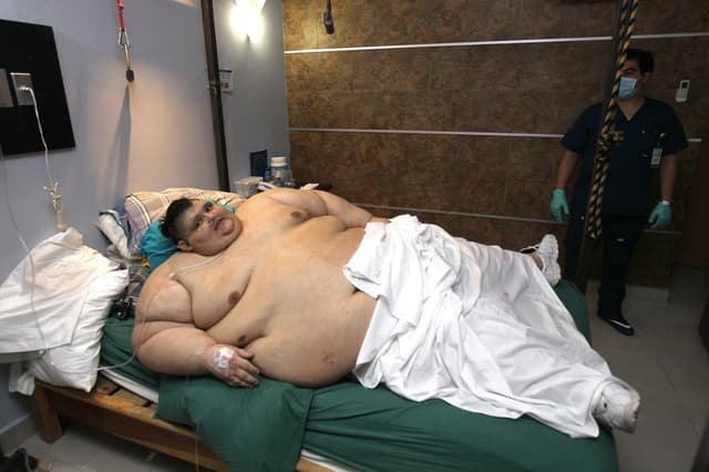 Muere Juan Pedro Franco, el mexicano que fue el hombre más obeso del mundo