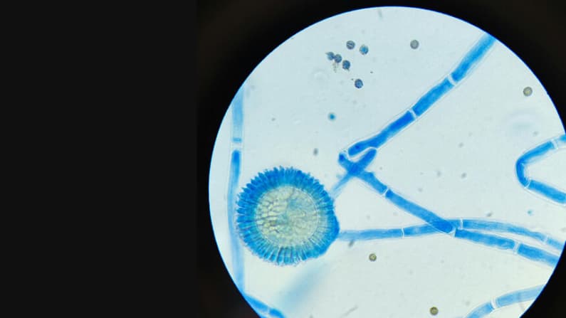 Los CDC alertan sobre más de 7700 casos de hongos multirresistentes en 30 estados