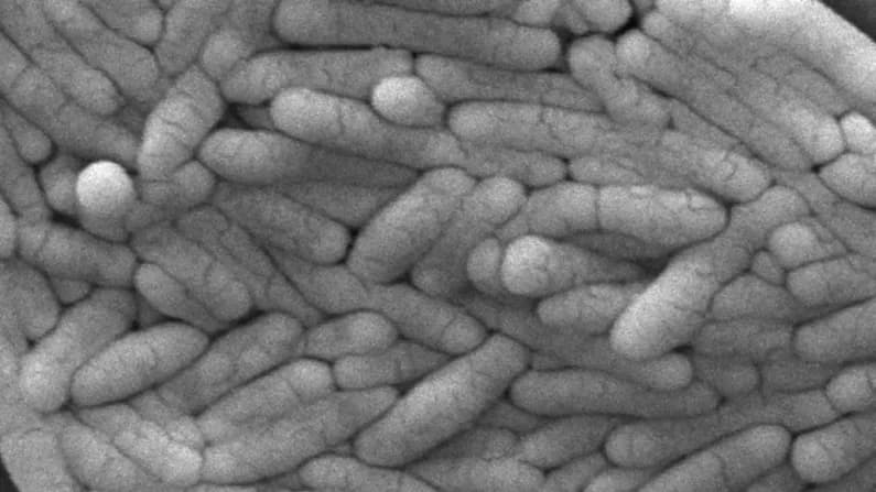 CDC alerta: Brote de salmonela en niños por camaleones domésticos