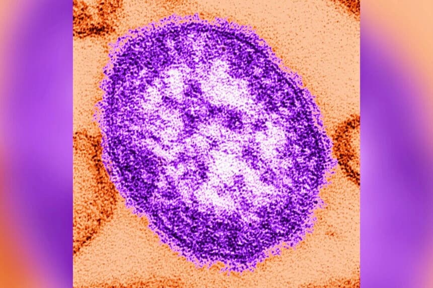 Una micrografía electrónica de transmisión (TEM) de sección delgada revela la apariencia ultraestructural de una sola partícula viral, o “virión”, del virus del sarampión. (CDC a través de Getty Images).