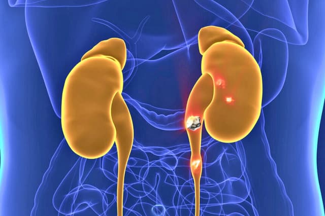 (decade3d - anatomía online/Shutterstock).