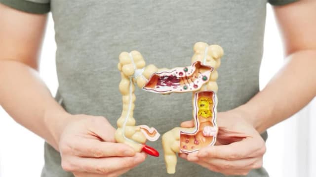 Casi el 45 % de cánceres colorrectales en EE. UU. ocurren en menores de 65 años, advierte estudio