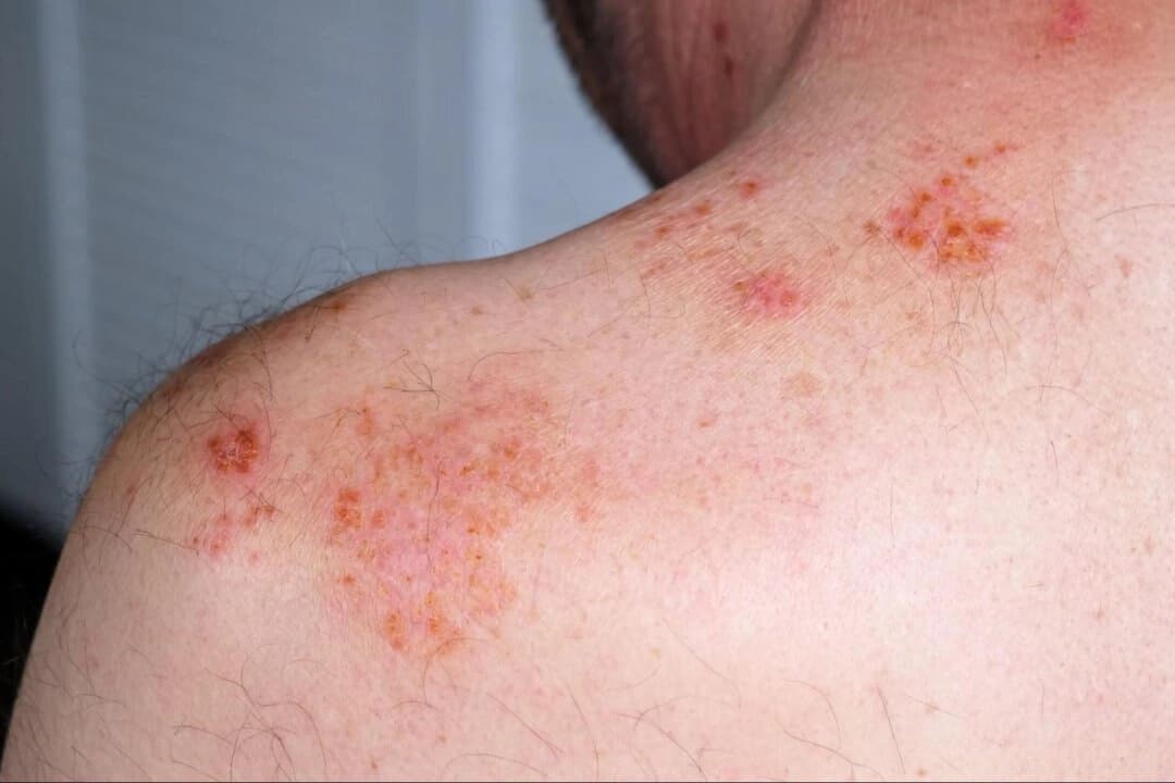 (Hanna Taniukevich/shutterstock)