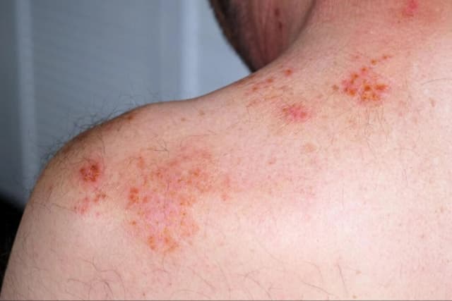 (Hanna Taniukevich/shutterstock)