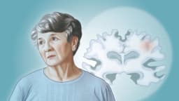 Un análisis de sangre ayuda a predecir la demencia con hasta 25 años de antelación, estudio