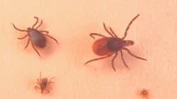 Los CDC lanzan advertencia sobre las picaduras de garrapatas y la enfermedad de Lyme