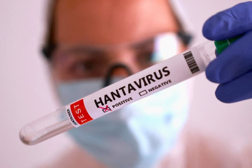 En esta ilustración, tomada el 7 de mayo de 2026, se muestra un tubo de ensayo con la etiqueta “Hantavirus positivo” en la mano. (Dado Ruvic/Reuters).