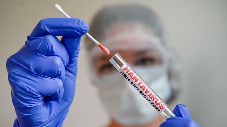 Kansas: 3 personas podrían haber estado expuestas a hantavirus tras contacto con caso positivo