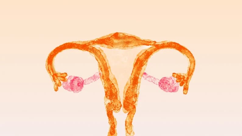 Nueva técnica de imagen no invasiva podría reducir en años el tiempo para diagnosticar endometriosis