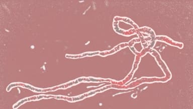 El virus del Ébola es mortal, pero he aquí por qué no debe preocuparse