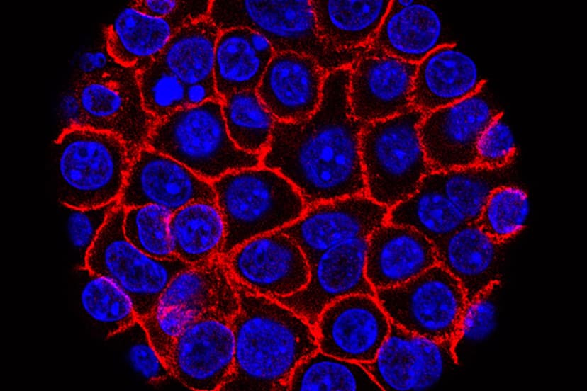 Células de cáncer de páncreas, núcleos en azul, creciendo como una esfera rodeada de membranas rojas. (Min Yu/Centro Eli y Edythe Broad para Medicina Regenerativa e Investigación con Células Madre en la USC, Centro Oncológico Integral USC Norris).