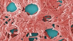 CDC advierten que el manejo inadecuado de la leche en polvo para bebés provocaría enfermedades graves
