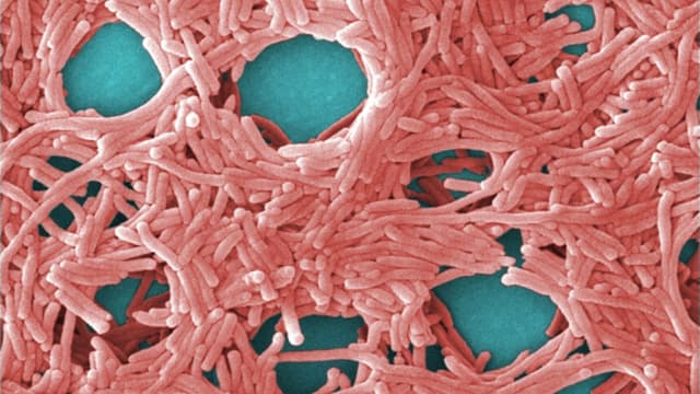 CDC advierten que el manejo inadecuado de la leche en polvo para bebés provocaría enfermedades graves