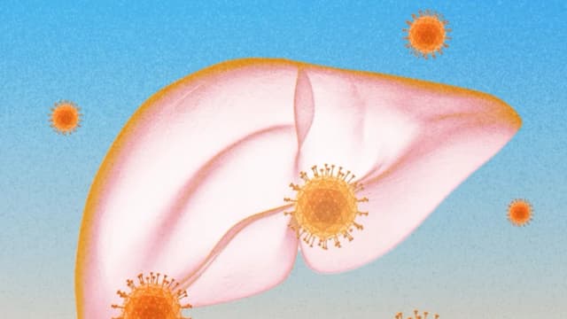 Nuevo medicamento promete cura para la hepatitis B crónica