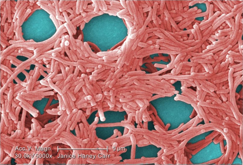 Micrografía electrónica de barrido (SEM) coloreada de la bacteria Legionella pneumophila. (Janice Haney Carr/CDC/Dominio público)