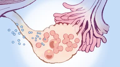 Síndrome de dolor pélvico crónico: 1 de cada 8 mujeres lo padecen, estas son las causas