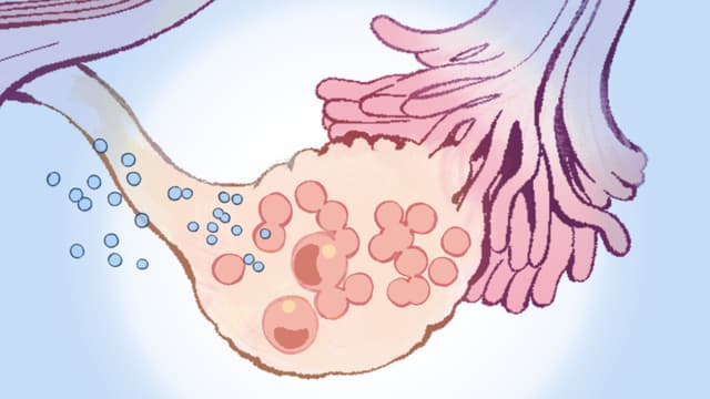 Síndrome de dolor pélvico crónico: 1 de cada 8 mujeres lo padecen, estas son las causas