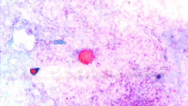 Ciclosporiasis: una infección parasitaria que aparece cada año y cómo protegerse