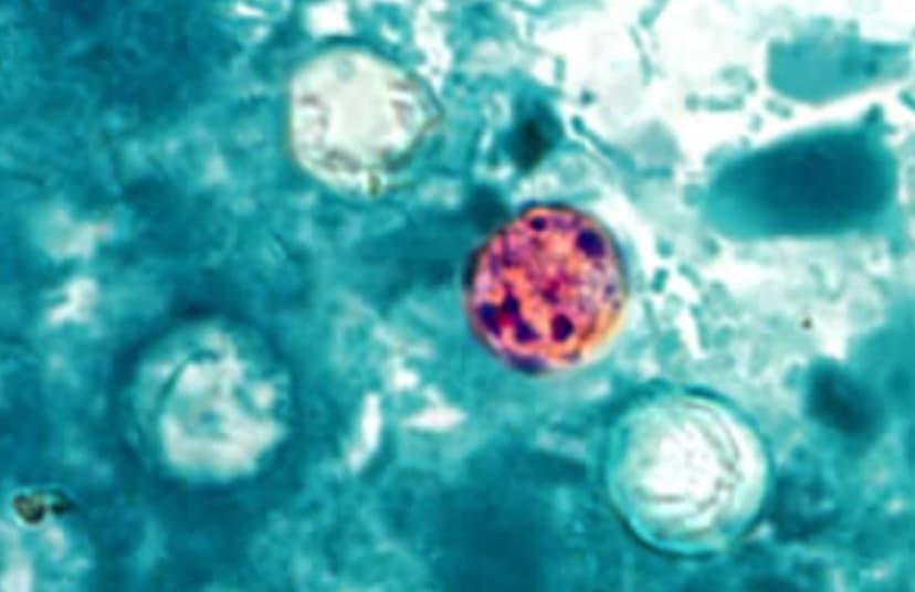 Oocistos de Cyclospora cayetanensis en una muestra de heces, en una imagen de archivo. (CDC vía The Epoch Times)