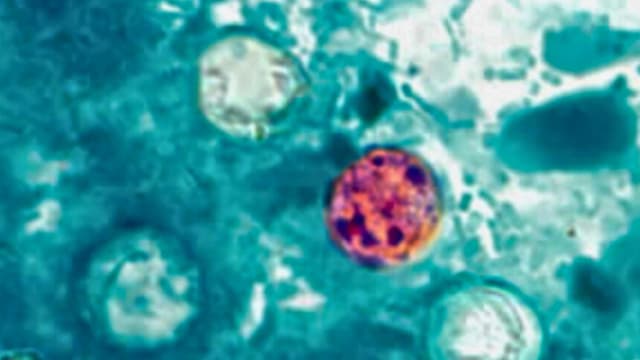 Se reportan casos de ciclosporiasis en 41 estados