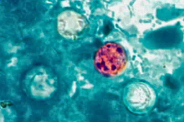 Se reportan casos de ciclosporiasis en 41 estados