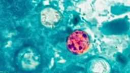 El mayor brote de ciclosporiasis en EE. UU. se extiende a nueve estados: CDC