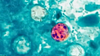 El mayor brote de ciclosporiasis en EE. UU. se extiende a nueve estados: CDC