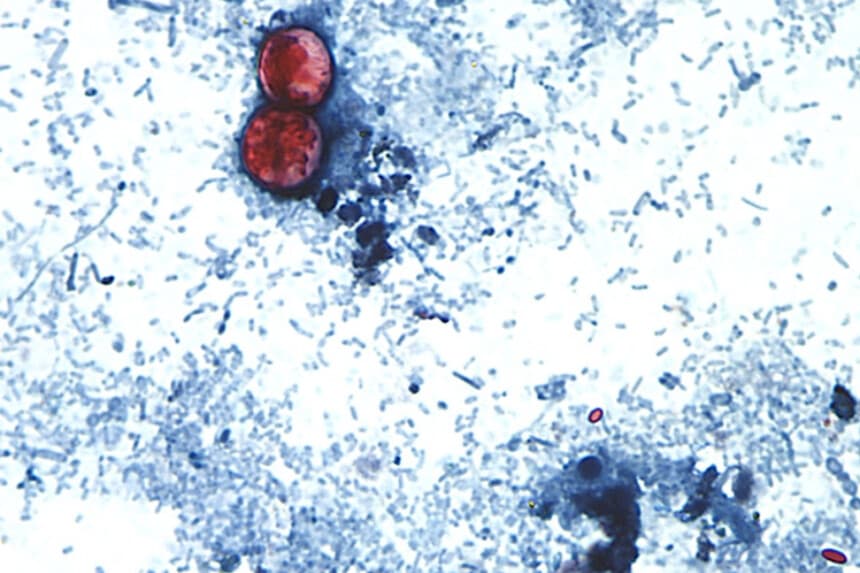 Esta fotografía sin fecha, tomada a través de un microscopio, muestra ooquistes de Cyclospora cayetanensis encontrados en una muestra de heces frescas que había sido preparada con una solución de formalina y teñida con safranina. (CDC vía AP).