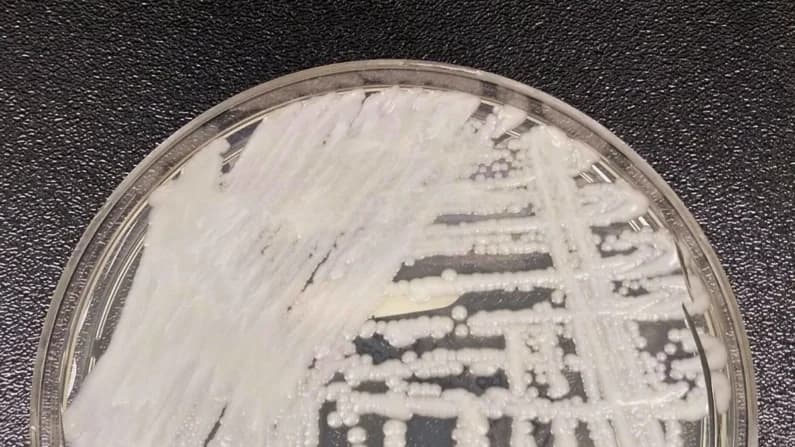 CDC reportan casos de hongo potencialmente mortal en 27 estados en lo que va del año