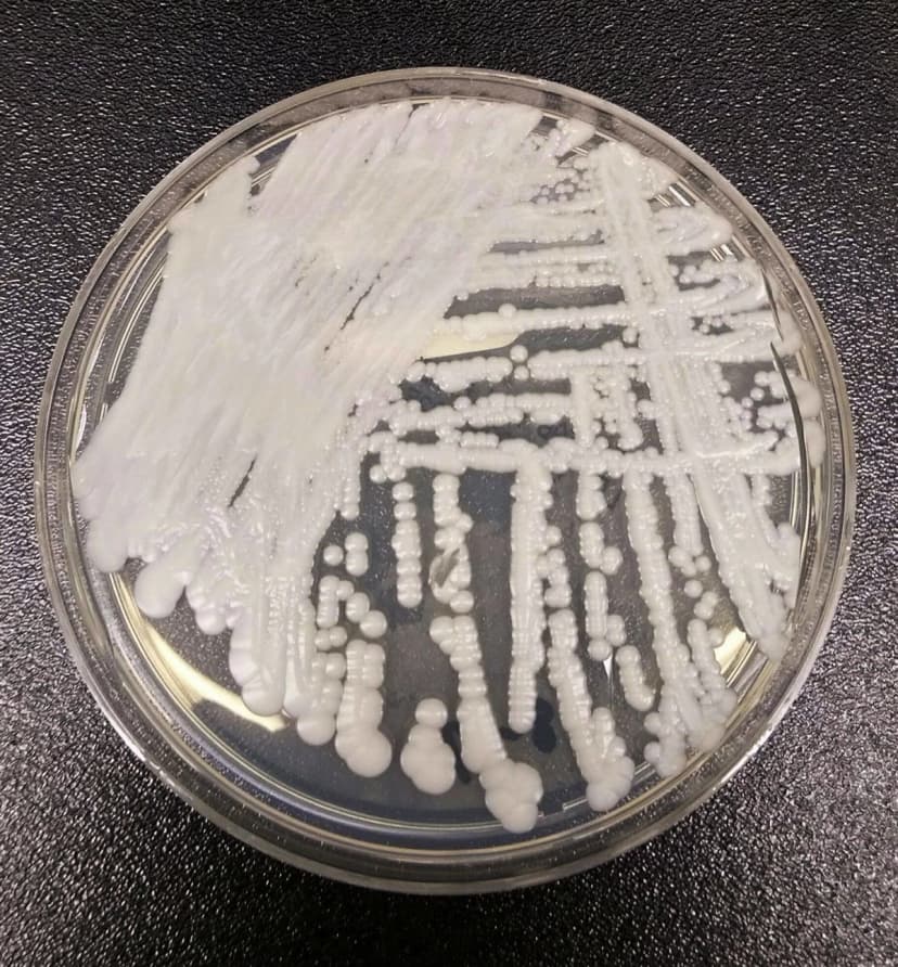 Esta foto sin fecha, proporcionada por los Centros para el Control y la Prevención de Enfermedades (CDC), muestra una cepa de Candida auris cultivada en una placa de Petri en un laboratorio de los CDC. (The Canadian Press/Shawn Lockhart-CDC vía AP)