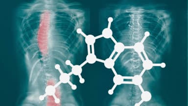 La relación entre la serotonina y la melatonina con la escoliosis