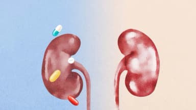 Proteja sus riñones: los suplementos y medicamentos comunes pueden afectarlos