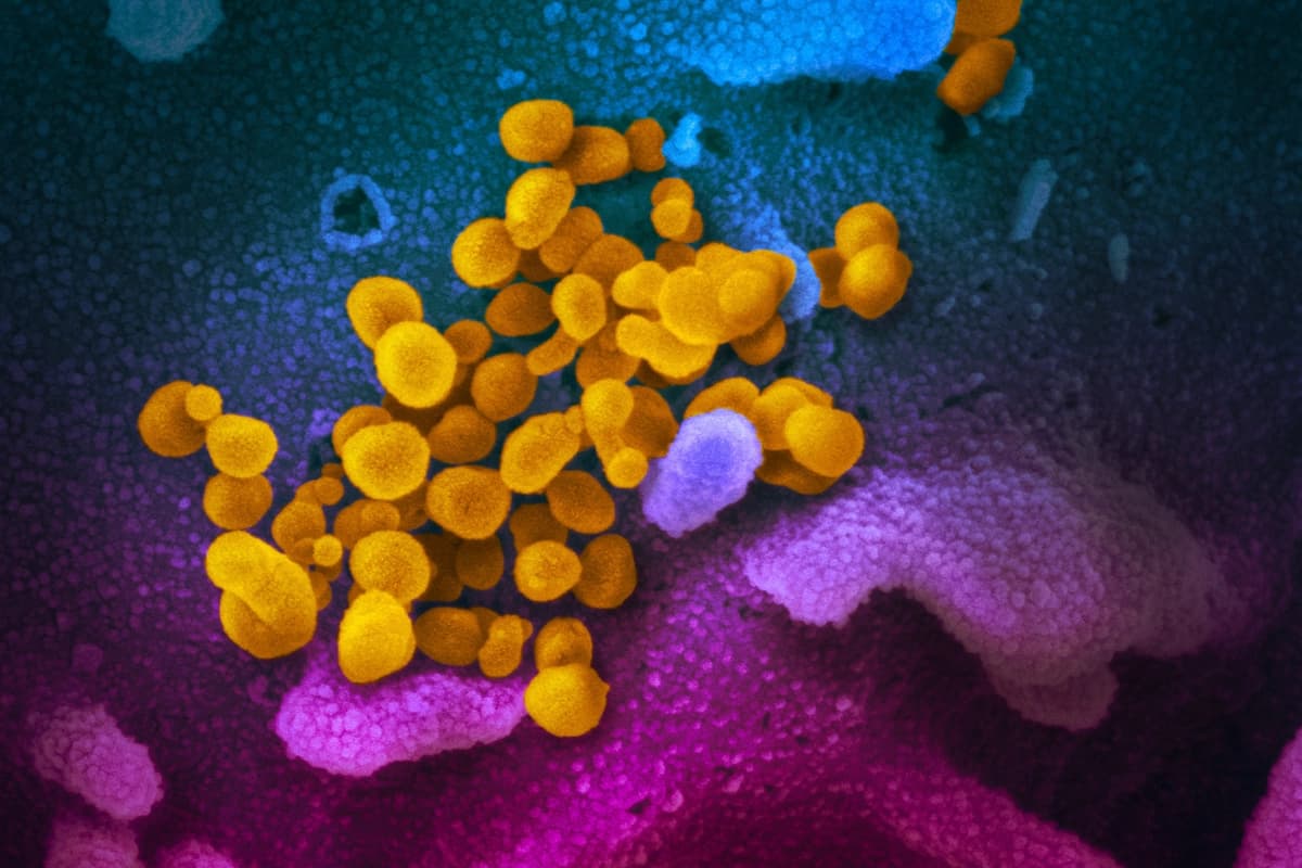 El virus COVID-19 se observa en color amarillo, emergiendo de las células. (NIAID)