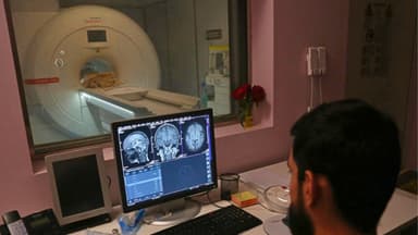 Un estudio vincula un sustituto común del azúcar con un mayor riesgo de infarto y accidente cerebrovascular