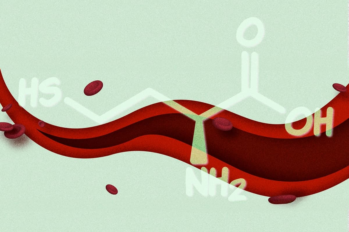 Niveles elevados de homocisteína relacionados con la fatiga: cómo reducirlos. (Ilustración de The Epoch Times, Shutterstock).