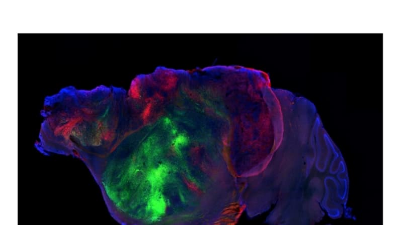 Científicos cartografían la corteza prefrontal para descifrar cómo cambia y enferma el cerebro