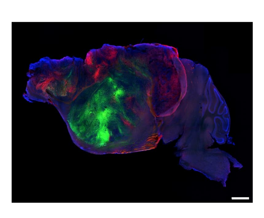 Vista lateral de un cerebro de ratón con xeno-corteza en la que se observan fibras nerviosas que se extienden desde el injerto humano (coloreadas con proteínas fluorescentes verdes y rojas) a través del cerebro del ratón (azul). (Crédito: S. Pasca lab, Stanford University)