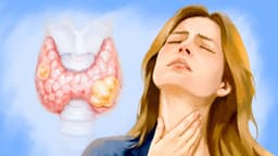 Cáncer de tiroides: silencioso pero tratable — 11 señales de alerta a las que hay que estar atentos