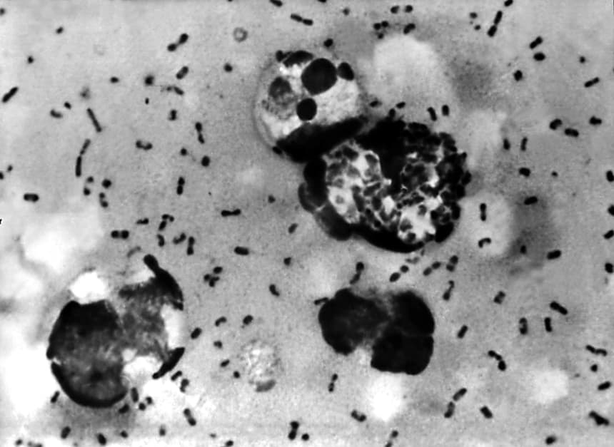 Un frotis de peste bubónica, preparado a partir de linfa extraída de un ganglio linfático adenopático, o bubón, de un paciente con peste, demuestra la presencia de la bacteria Yersinia pestis, causante de varios tipos de peste, entre ellos la peste bubónica, la septicémica y la neumónica. (Foto sin fecha, Centros para el Control y la Prevención de Enfermedades/Getty Images)