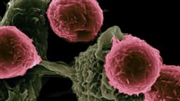 Estudio alerta que el cáncer es la principal causa de muerte entre los latinos en EE. UU.