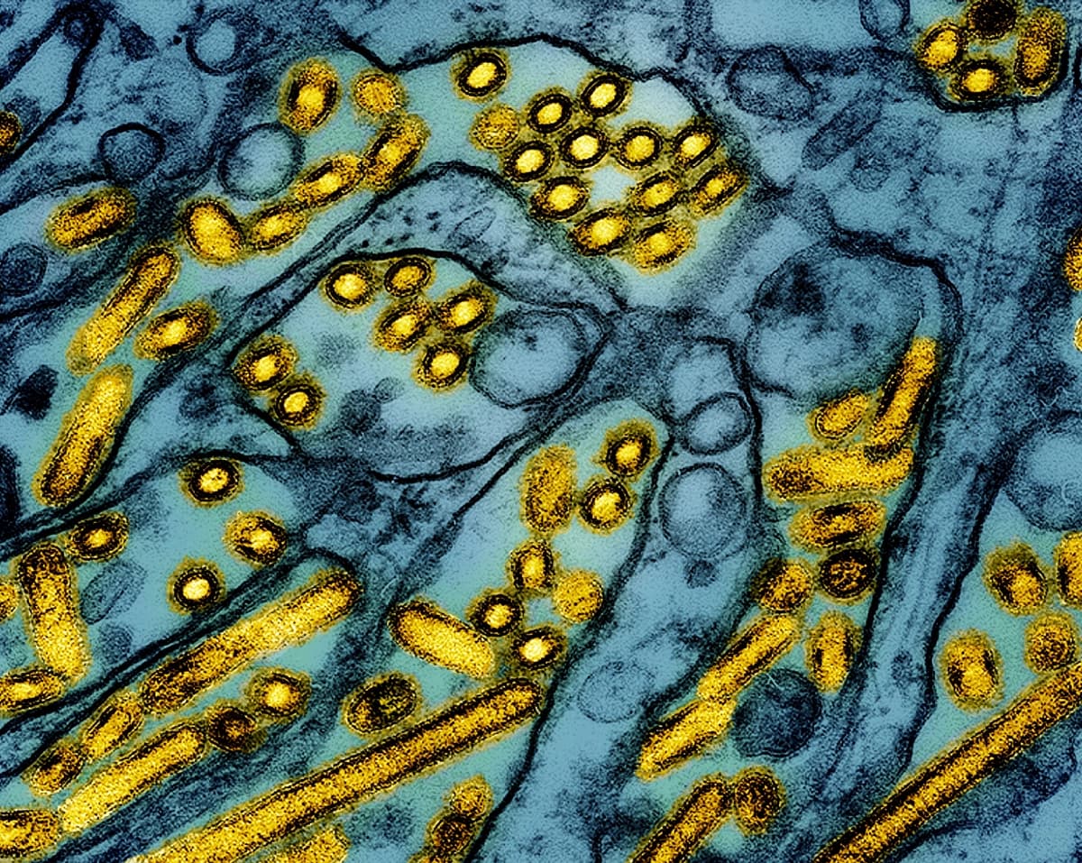 Una imagen de microscopio electrónico coloreada, publicada el 26 de marzo de 2024, muestra partículas del virus de la influenza aviar A H5N1 (en amarillo), cultivadas en células epiteliales de riñón canino Madin-Darby (MDCK) (en azul). (CDC/NIAID vía AP).