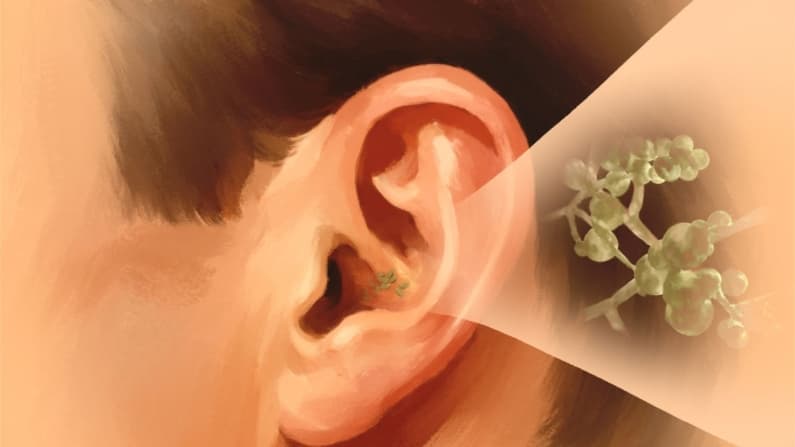 Candida auris: un hongo que suele ser resistente a múltiples medicamentos; estas son las causas
