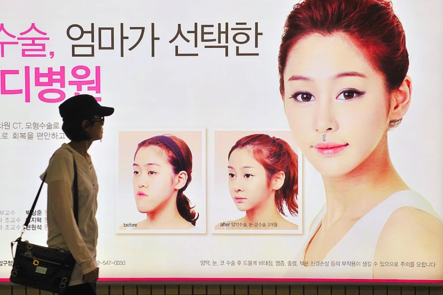 RELACIONADO CON: Salud-Corea del Sur-cirugía estética, Esta fotografía, tomada el 22 de mayo de 2013, muestra a una mujer surcoreana pasando junto a una valla publicitaria que anuncia la cirugía de doble mandíbula en una estación de metro de Seúl. Imagen ilustrativa (JUNG YEON-JE/AFP vía Getty Images)