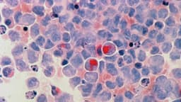 FDA debería permitir probar nuevos tratamientos contra el cáncer