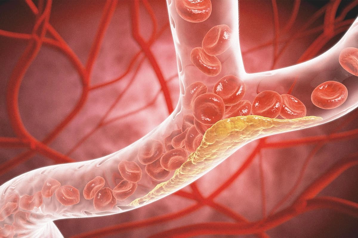 Más allá del colesterol. (Anusorn Nakdee/Shutterstock).