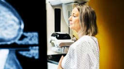 ¿Cuántas vidas salvan realmente las mamografías?