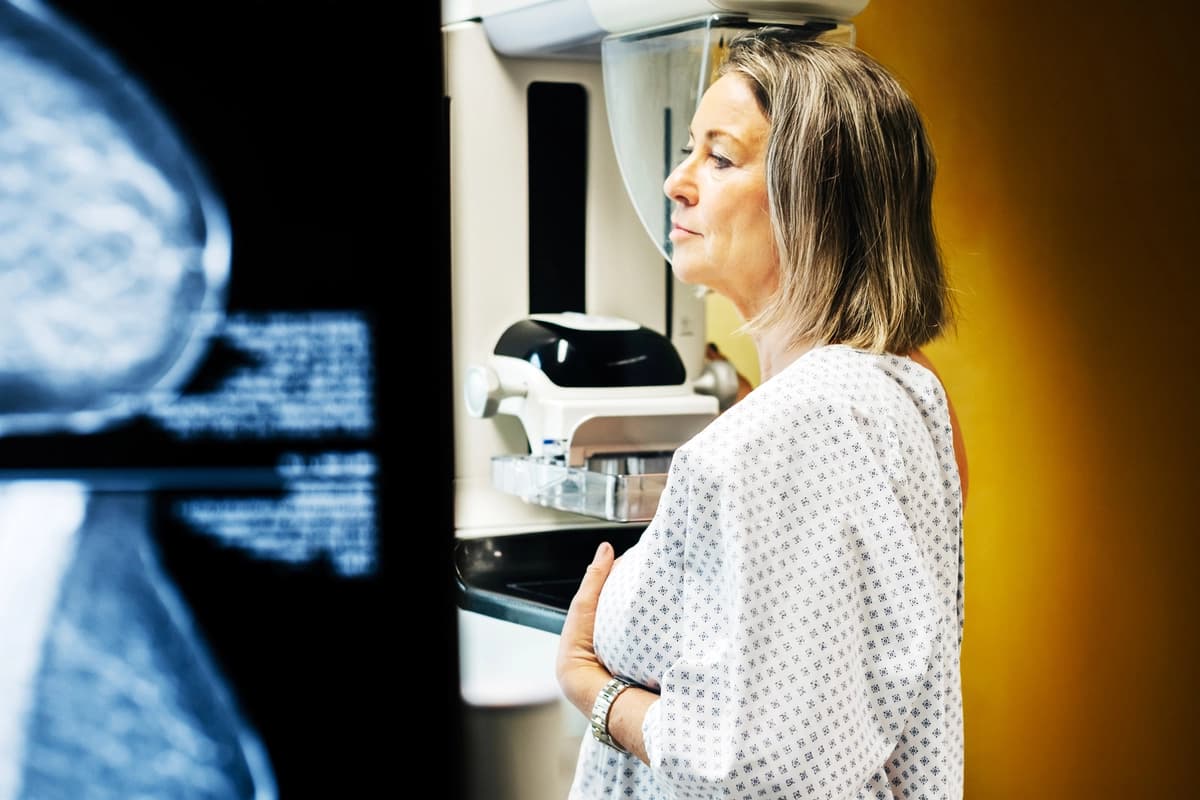 Las mamografías detectan el cáncer en etapas tempranas, pero ¿cuántas vidas se salvan? (Tom Werner/Getty Images).